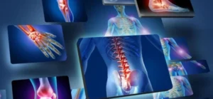 triflexarin Joint Pain